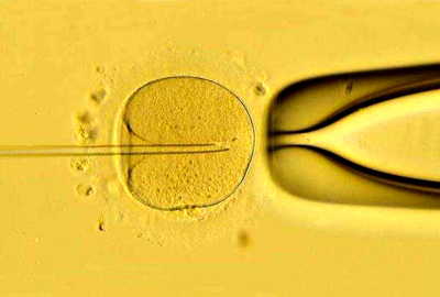 去新加坡做试管：科学促排卵避免卵巢过度刺激症OHSS