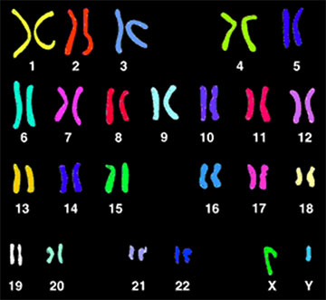 人类染色体g显带