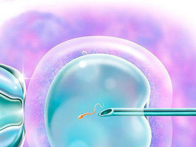 胚胎移植后腹胀是好是坏?