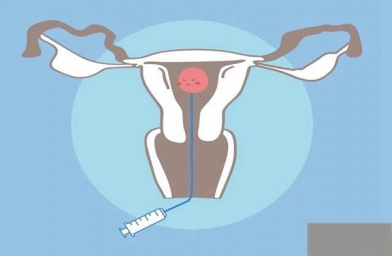 在试管婴儿中胚胎质量和试管婴儿成功率有什么联系吗？