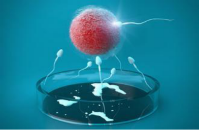 导致试管婴儿反复流产的精子质量问题是什么？