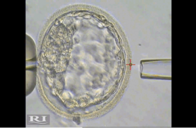 囊胚的培养才是三代试管成功的关键所在
